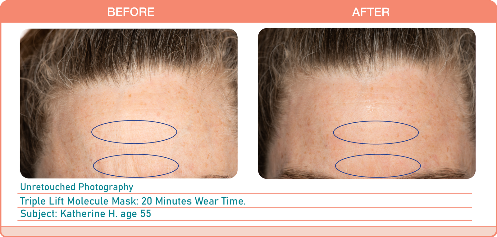 Caire Triple Lift Molecule Mask - AILLEA
