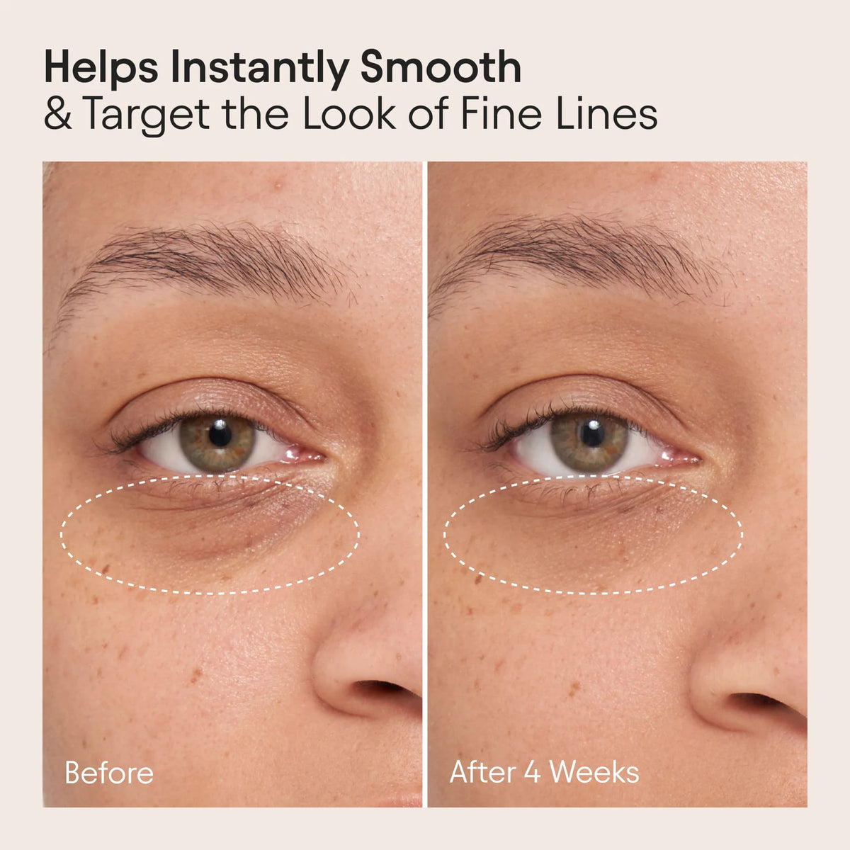 Alpyn Line-Filling Eye Balm - AILLEA